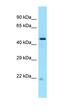 NOP53 Ribosome Biogenesis Factor antibody, orb326526, Biorbyt, Western Blot image 