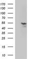 Matrix Metallopeptidase 13 antibody, TA506692, Origene, Western Blot image 