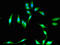 PKHD1 Ciliary IPT Domain Containing Fibrocystin/Polyductin antibody, orb51406, Biorbyt, Immunocytochemistry image 
