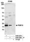RAB1A, Member RAS Oncogene Family antibody, A305-327A, Bethyl Labs, Immunoprecipitation image 