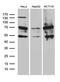 Zinc Finger Protein 2 antibody, M11482, Boster Biological Technology, Western Blot image 
