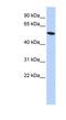 Zinc Finger Protein 572 antibody, NBP1-80157, Novus Biologicals, Western Blot image 