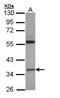 3-Hydroxy-3-Methylglutaryl-CoA Lyase antibody, PA5-21996, Invitrogen Antibodies, Western Blot image 