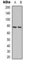 Moesin antibody, orb338852, Biorbyt, Western Blot image 