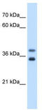 Glycerophosphodiester Phosphodiesterase 1 antibody, TA342023, Origene, Western Blot image 