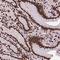 Small Integral Membrane Protein 5 antibody, NBP2-49650, Novus Biologicals, Immunohistochemistry paraffin image 