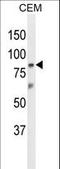 Zinc Finger Protein 160 antibody, LS-C160804, Lifespan Biosciences, Western Blot image 