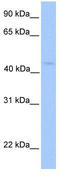 LIPT1 antibody, TA346780, Origene, Western Blot image 