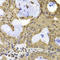 TERF2 Interacting Protein antibody, A02374, Boster Biological Technology, Immunohistochemistry paraffin image 