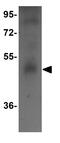 Calcium-binding and spermatid-specific protein 1 antibody, GTX31395, GeneTex, Western Blot image 