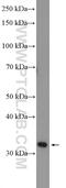 Leucine Rich Repeat Containing 38 antibody, 55479-1-AP, Proteintech Group, Western Blot image 