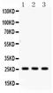 Surfactant Protein A1 antibody, PA5-79987, Invitrogen Antibodies, Western Blot image 