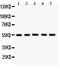 Solute Carrier Family 2 Member 4 antibody, PA1722, Boster Biological Technology, Western Blot image 