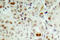 RB Transcriptional Corepressor 1 antibody, LS-C177946, Lifespan Biosciences, Immunohistochemistry paraffin image 