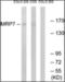 ATP Binding Cassette Subfamily C Member 10 antibody, orb376037, Biorbyt, Western Blot image 