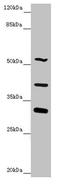 Nyctalopin antibody, LS-C676203, Lifespan Biosciences, Western Blot image 