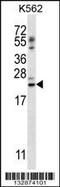 Psoriasis susceptibility 1 candidate gene 1 protein antibody, 56-912, ProSci, Western Blot image 
