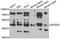 Zinc finger and BTB domain-containing protein 25 antibody, STJ29637, St John