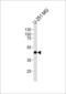 Atypical Chemokine Receptor 3 antibody, LS-C167174, Lifespan Biosciences, Western Blot image 