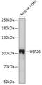 Ubiquitin Specific Peptidase 26 antibody, 23-339, ProSci, Western Blot image 