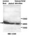 ACAT-2 antibody, orb76998, Biorbyt, Western Blot image 