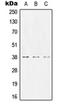 Carcinoembryonic Antigen Related Cell Adhesion Molecule 8 antibody, orb213728, Biorbyt, Western Blot image 