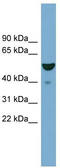 F-Box Protein 9 antibody, TA329830, Origene, Western Blot image 