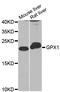 Glutathione Peroxidase 1 antibody, LS-C331264, Lifespan Biosciences, Western Blot image 