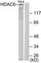 Histone Deacetylase 6 antibody, TA312294, Origene, Western Blot image 