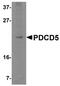 Programmed Cell Death 5 antibody, NBP1-76991, Novus Biologicals, Western Blot image 