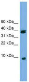 Ribosomal Protein S21 antibody, TA336065, Origene, Western Blot image 