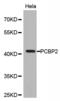 Poly(rC)-binding protein 2 antibody, PA5-76661, Invitrogen Antibodies, Western Blot image 