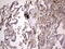 Dedicator of cytokinesis protein 8 antibody, M01771, Boster Biological Technology, Immunohistochemistry paraffin image 