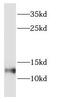 Dynein light chain Tctex-type 1 antibody, FNab02590, FineTest, Western Blot image 