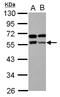 Zinc Finger And BTB Domain Containing 9 antibody, LS-C155488, Lifespan Biosciences, Western Blot image 