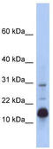 Histone Cluster 2 H2B Family Member F antibody, TA336063, Origene, Western Blot image 