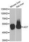 Angiotensinogen antibody, STJ28201, St John