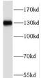 PHD Finger Protein 20 antibody, FNab06385, FineTest, Western Blot image 