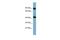 Isovaleryl-CoA dehydrogenase, mitochondrial antibody, PA5-44896, Invitrogen Antibodies, Western Blot image 