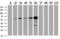 Epoxide Hydrolase 2 antibody, GTX84569, GeneTex, Western Blot image 