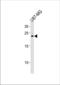 Ciliary Neurotrophic Factor antibody, TA325126, Origene, Western Blot image 