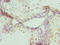 Nucleoside diphosphate kinase, mitochondrial antibody, LS-C676168, Lifespan Biosciences, Immunohistochemistry paraffin image 