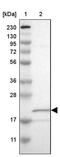 NME/NM23 Nucleoside Diphosphate Kinase 6 antibody, PA5-53665, Invitrogen Antibodies, Western Blot image 