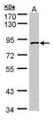 SCY1 Like Pseudokinase 3 antibody, TA308183, Origene, Western Blot image 