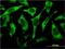 Ribosomal Protein L17 antibody, H00006139-M01, Novus Biologicals, Immunocytochemistry image 