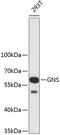 Glucosamine (N-Acetyl)-6-Sulfatase antibody, 19-199, ProSci, Western Blot image 