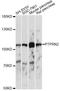 Protein Tyrosine Phosphatase Receptor Type N2 antibody, A14774, ABclonal Technology, Western Blot image 