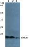 High Mobility Group Nucleosome Binding Domain 1 antibody, A03051, Boster Biological Technology, Western Blot image 