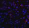 DExD/H-Box Helicase 58 antibody, NBP1-76732, Novus Biologicals, Immunocytochemistry image 