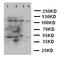 Cytosolic phospholipase A2 antibody, LS-C313173, Lifespan Biosciences, Western Blot image 
